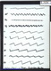 Slide: Bowed strings